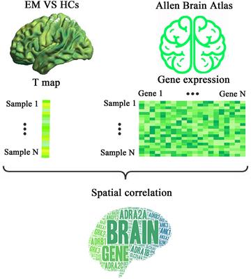 Genetic mechanisms underlying local spontaneous brain activity in episodic migraine